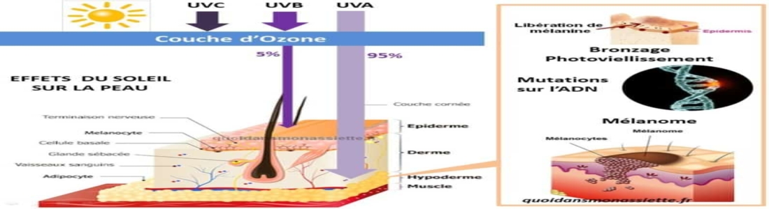 effets soleil peau uv ultraviolet exposition mutations cancer esthéticienne castries